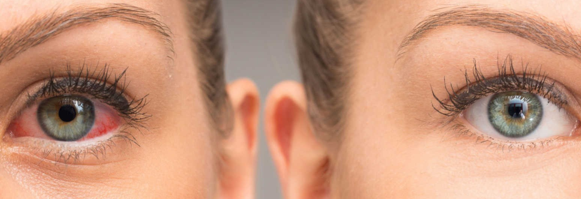 🟢 Settimana della Consapevolezza sul Glaucoma: quando prevenire è davvero salvare la vista